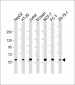 DCLRE1C Antibody (N-term)